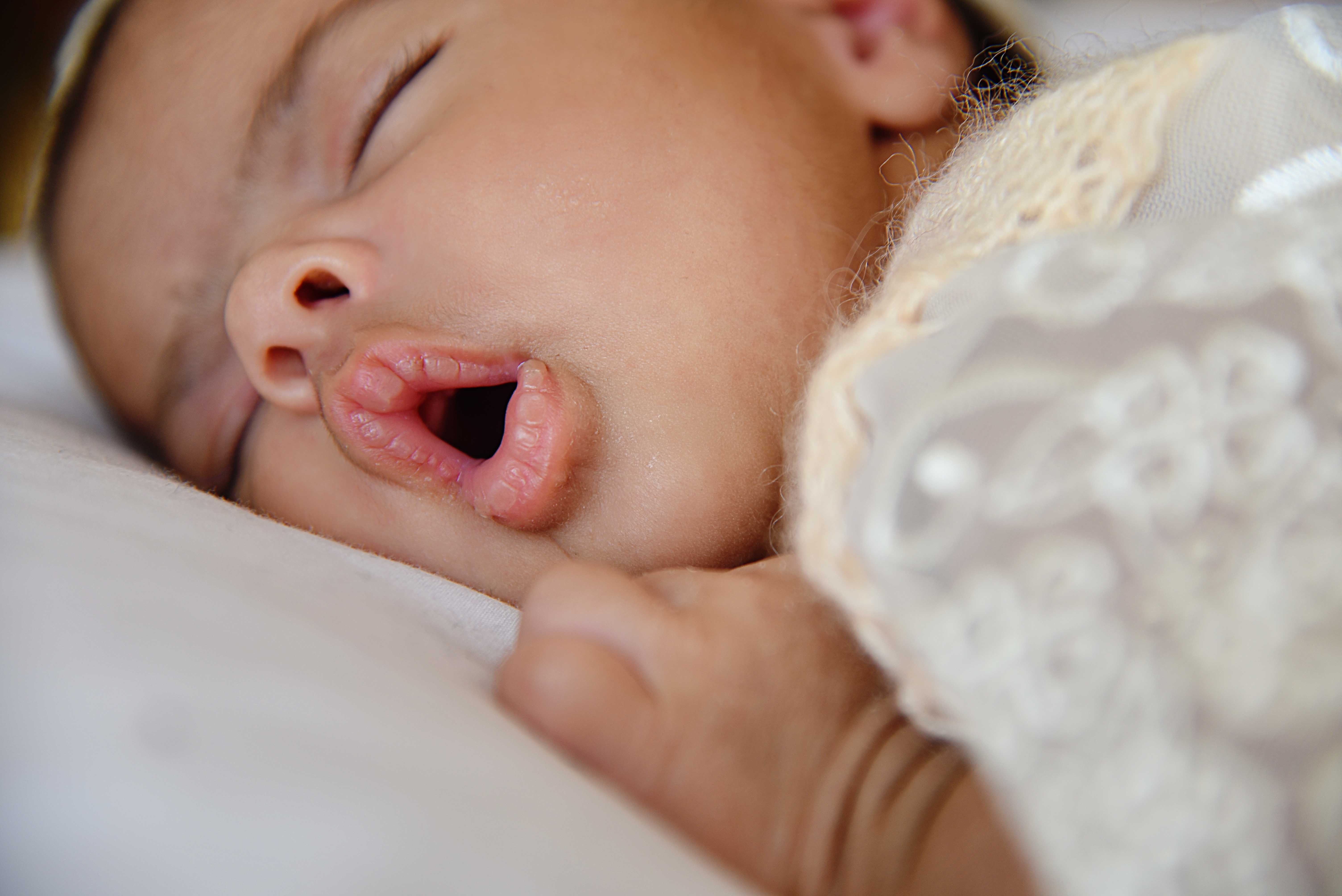 Child Referred to an ENT for Tonsils and Adenoids: Now What?